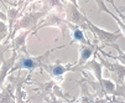 ViraDuctin™ Adenovirus Transduction Reagent