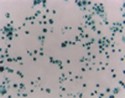 CytoSelect™ Leukocyte Transmigration Assay