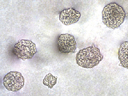 CytoSelect™ 96-Well In Vitro Tumor Sensitivity Assay