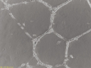 Endothelial Tube Formation Assay (In Vitro Angiogenesis)