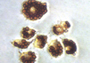 Phagocytosis Assay, Zymosan Substrate