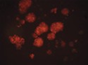 CytoSelect™ 96-Well Anoikis Assay