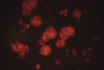 MTT Cell Proliferation Assay