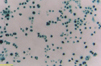 Leukocyte Endothelium Adhesion Assay