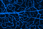 Lipoprotein Metabolism