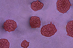 Tumor Transendothelial Migration Assay